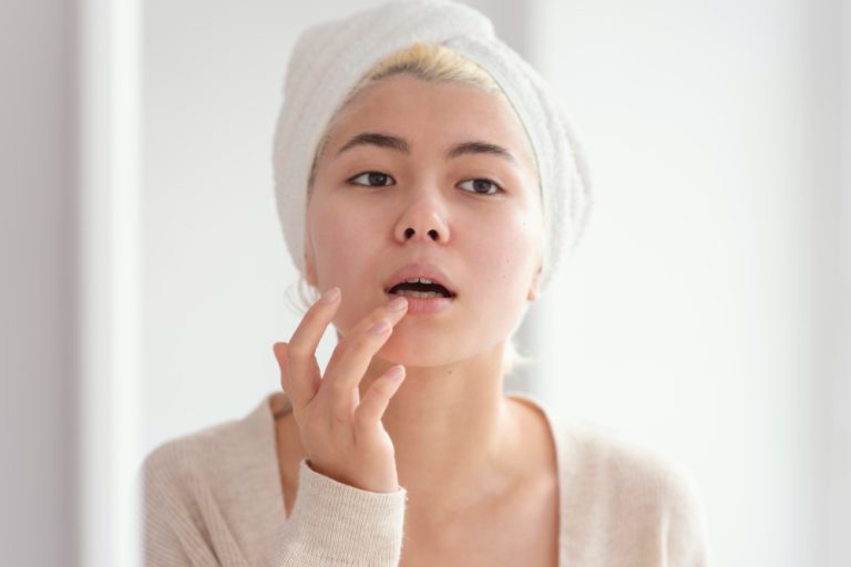 penyebab bibir bengkak